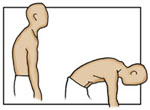 postural-kyphosis